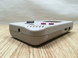 LG6719 With Defects - GameBoy Original DMG-01 Console Nintendo Japan