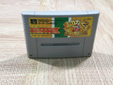 Kirby Super Deluxe Star Kirby's Fun Pak - UF6382